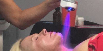 Cryotherapy for the face